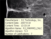Calcification information