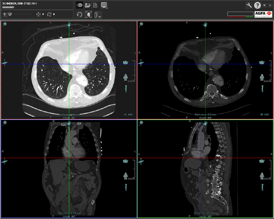 Volume Viewing interface