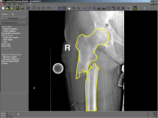 Orthopaedic Application window