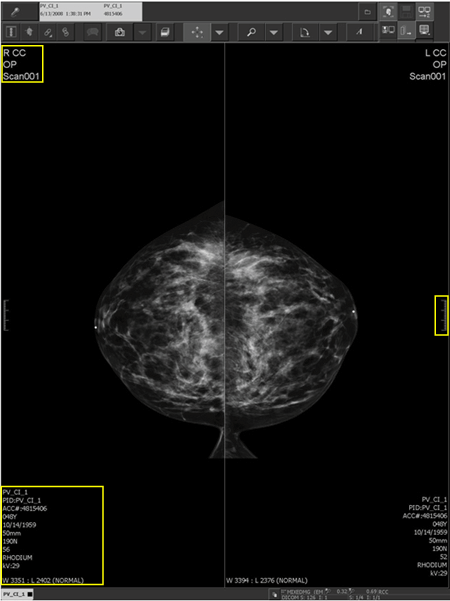 Breast imaging demographics