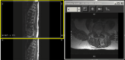 Scout window and corresponding slice location