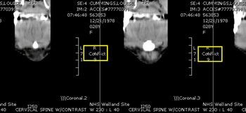 Image conflicts highlighted