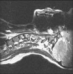 Image rotated 90 degrees to the right