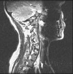 Image flipped vertically