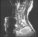 Image flipped horizontally