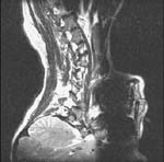 Image rotated 180  degrees