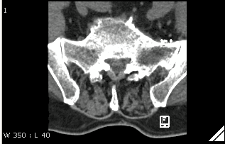 Image with lossy indicator