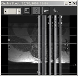 Scout with with Multiline Scout on