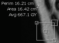 Markup rectangle with measurement values and control points