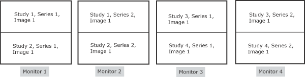 Monitor 1: Study 1,Series 1, Image 1  and Study 2, Series 1, Images 1; Monitor 2: Study 1, series 1, Image 1 and Study 2, Series 2, Image 1; Third monitor: Study 3, Series 1, Image 1, and Study 4, Series 1, Image 1; Fourth monitor: Study 3, Series 2, Image 1 and Study 4, Series 2, and Image 1