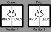 Monitor 1: Current RMLO, LMLO; Monitor 2: Prior RMLO, LMLO