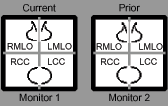 Monitor 1: Current RMLO, LMLO, RCC, LCC; Monitor 2: Prior RMLO, LMLO, RCC, LCC