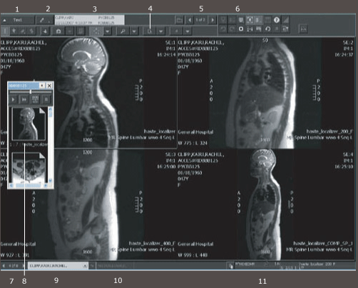 Image area with callouts