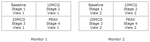 Two-stage stress exam over four monitors
