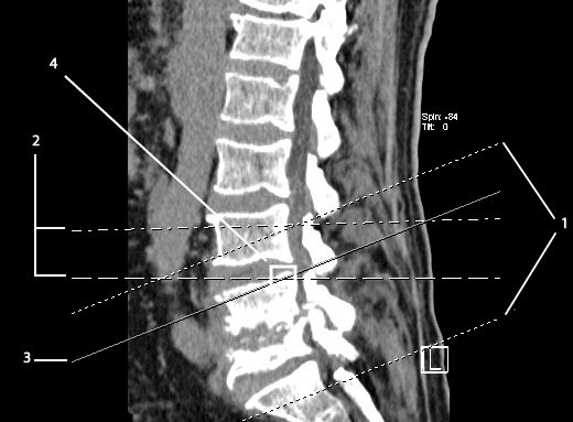Reference Lines overview