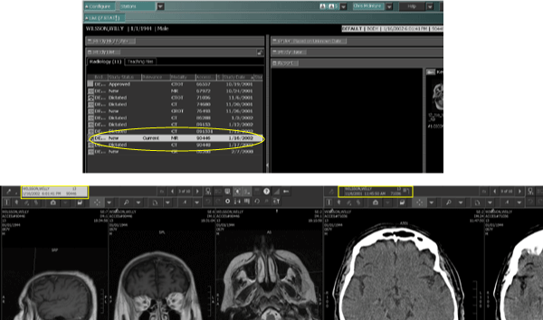 Study List synchronized to first study