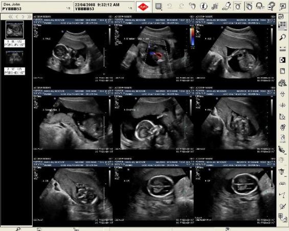 CD image viewer window