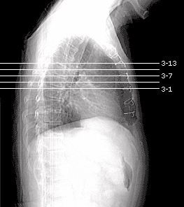 Example of scout with every third line printed and every second line labeled