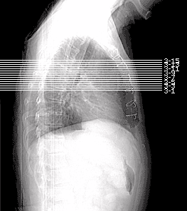 Example of scout with every line printed and every second line labeled
